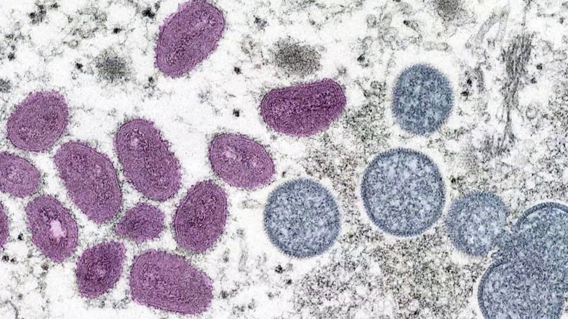 Mpox Virus